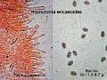 Hypholoma ericaeoides-amf984-micro